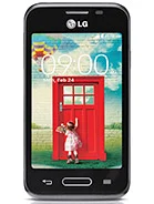 Lg L40 D160 rasmi va to'liq xarakteristikalari — PhoneCompare